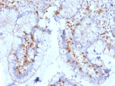 FFPE human small intestine sections stained with 100 ul anti-CD103 (clone ITGAE/2063) at 1:400. HIER epitope retrieval prior to staining was performed in 10mM Citrate, pH 6.0.